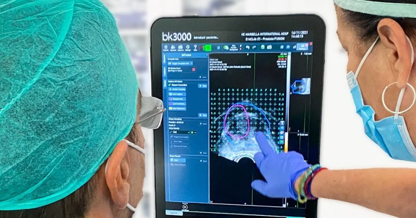 Biopsia por fusión de imágenes