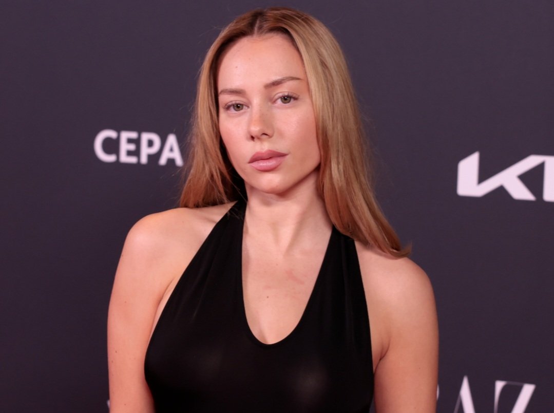 Los retoques estéticos de Ester Expósito