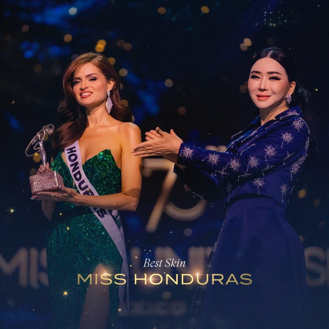 Stephanie Cam, Miss Universo Honduras 2024, ganó  el prestigioso Best Skin Award con el respaldo del Dr. Elio Galán