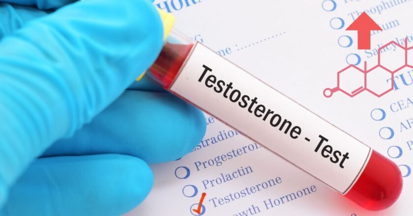 LA  TESTOSTERONA TAMBIÉN ES VITAL PARA LA MUJER